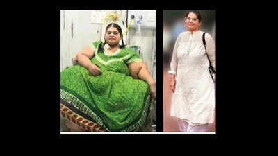 42-year-old Vasai woman loses 214 kg, gets new lease of life