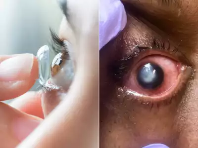 This is why you should NOT sleep in your contact lenses!