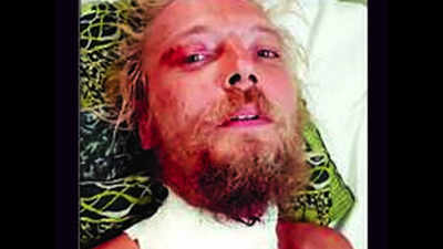 Mathura: Latvian slaps man who greeted him with ‘Ram, Ram’, stabbed