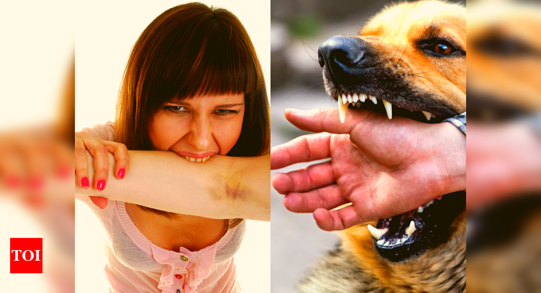 Are human bites as dangerous as a dog bite? We tell you - Times of India