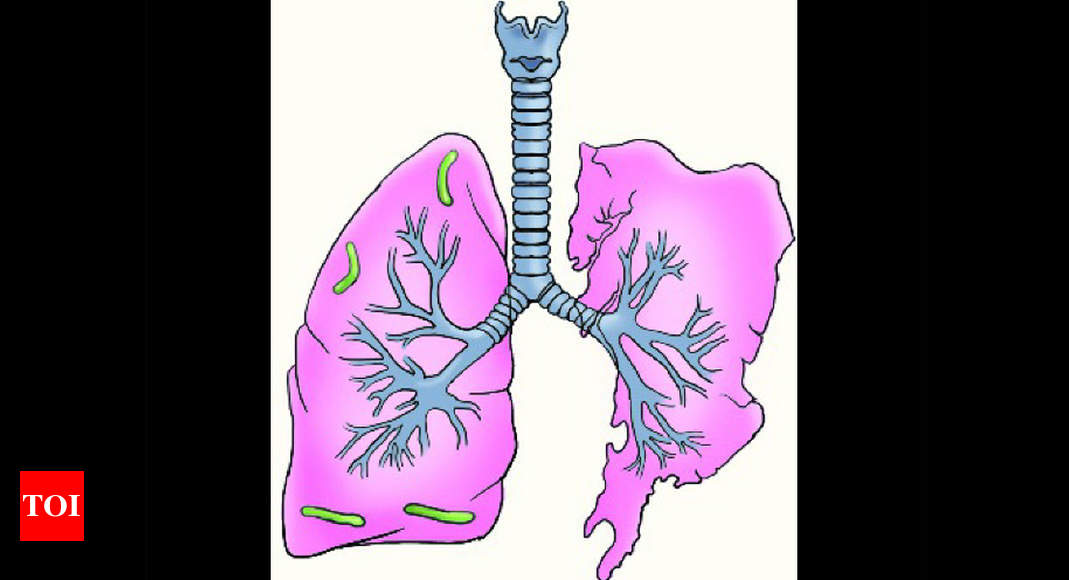 ‘Lung cancer on rise among non-smokers’ | Hyderabad News - Times of India