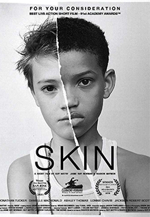 Skin