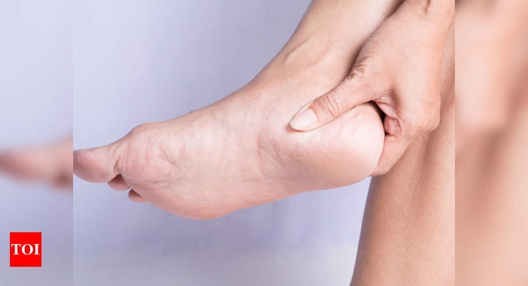 home remedies for cracked heels and feet