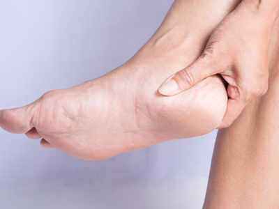 Foot Care: How to Prevent and Heal Cracked Heel | Healthy Living