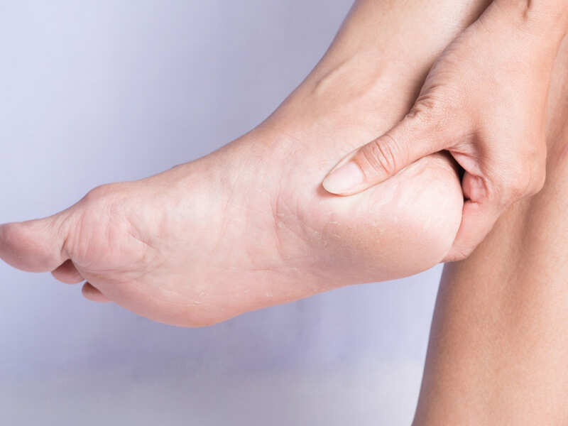 get rid of cracked heels at home