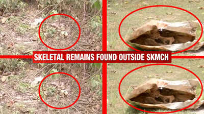 Bihar: Hundreds of skeletal remains found behind Sri Krishna Medical College and Hospital in Muzaffarpur