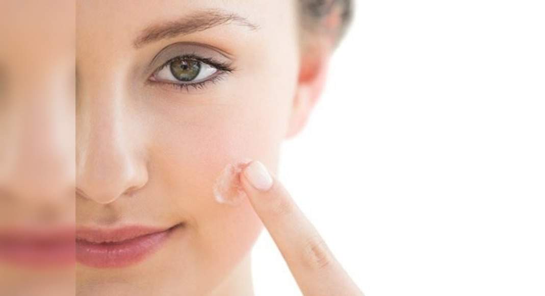 Acne Treatment: These tips will help you subdue that acne on your skin