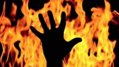 Ghaziabad: Man sets mother on fire