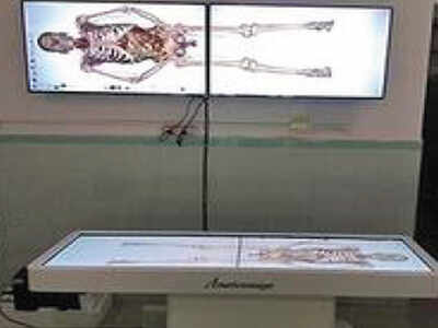 Anatomage Table 6 Price | Pictures New Idea