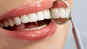 Root canal isn't that bad!