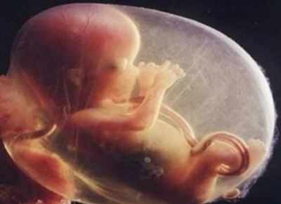 Abortion of abnormal foetus can't be denied even if gestation is beyond 20 weeks: HC