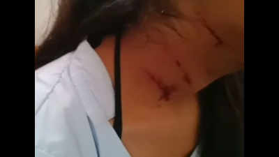 MP: Bikers attack schoolgirl with knife in Ujjain
