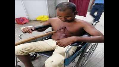 West Bengal: Bamboo weapon pierces man's chest; victim critical