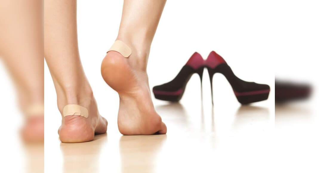Do you get too many shoe bites? These easy home remedies will help