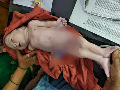 Kheri woman gives birth to ‘mermaid’ baby who dies within an hour
