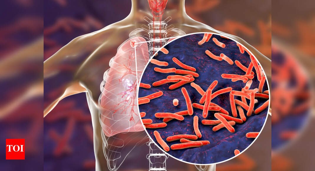 Indian scientists claim to have found 100 cure for tuberculosis