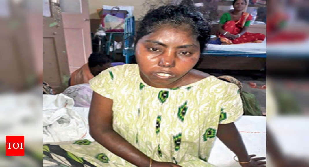 Kachua tragedy: Some of the youths reeked of alcohol | Kolkata News ...