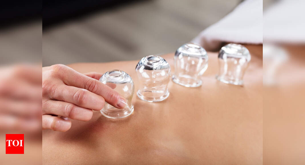 Here's why celebrities are raving over cupping therapy! - Times of India