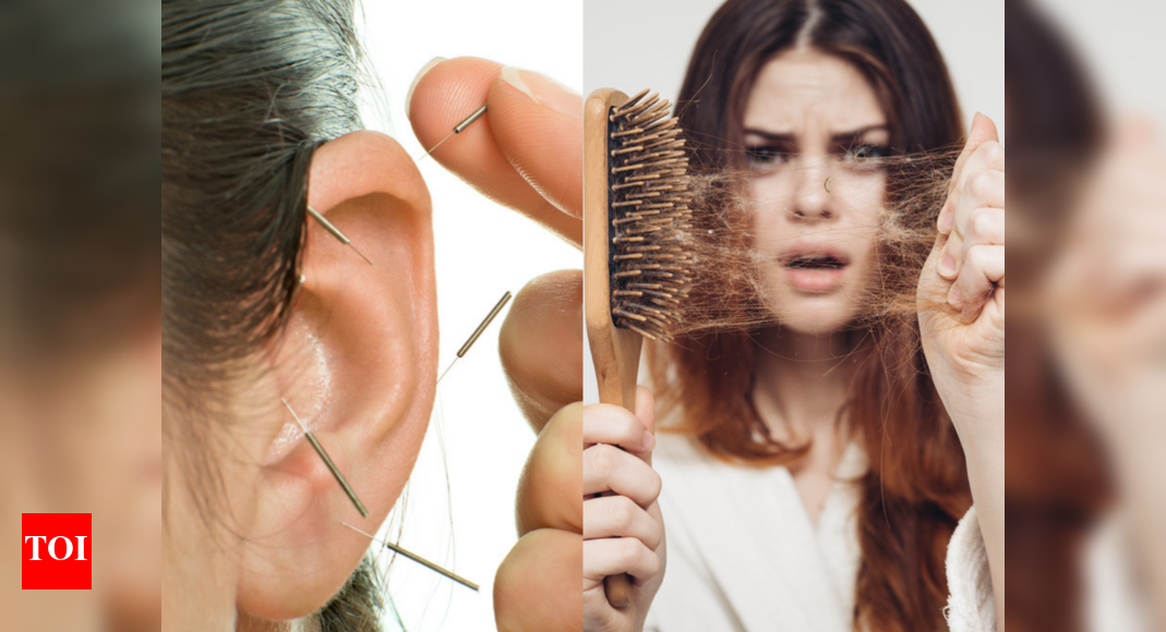 Acupuncture for hair loss: How does it help? - Times of India Acupuncture for hair loss: How does it help? - Times of India