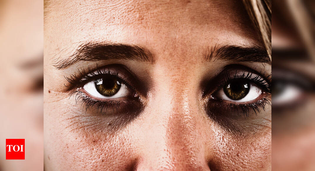 Tips To Remove Black Circles Around Eyes In Tamil Makeupview.co