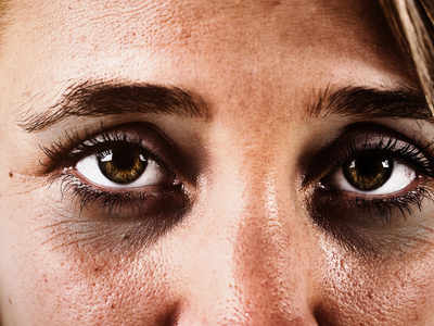 Foods that help in reducing dark circles naturally - Times of India
