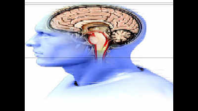 Now, brain pacemaker to treat Parkinson’s at PGI