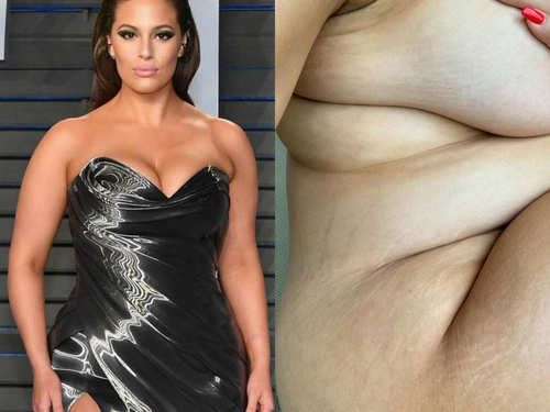 5 Celebrities That Have Embraced Their Stretch Marks