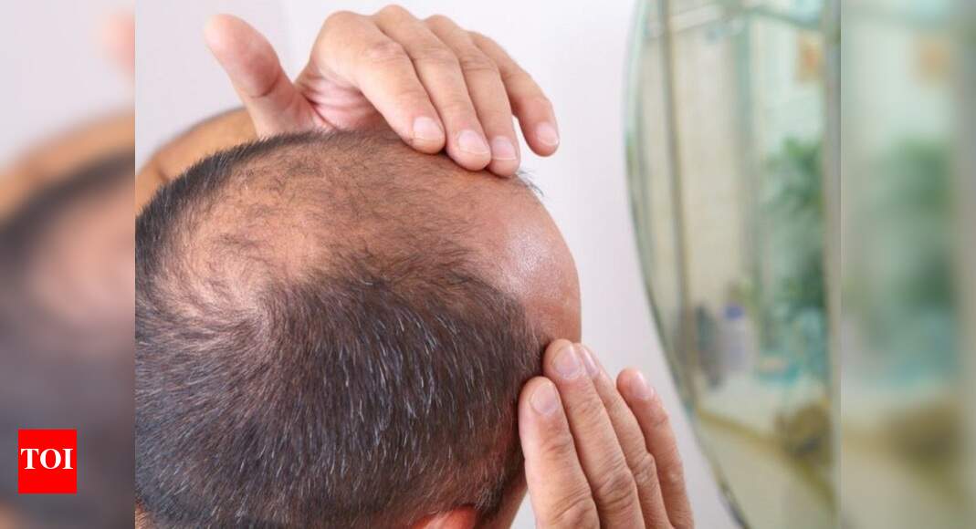 Electric Hat May Help Reverse Baldness Times Of India