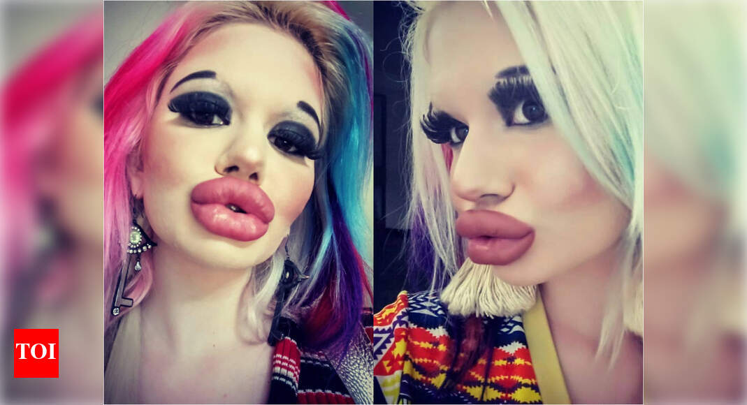 Woman triples the size of her lips and spends a fortune! - Times of India