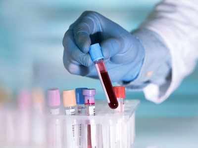 Blood Reports And Statistics In It: All You Need To Know - Times Of India