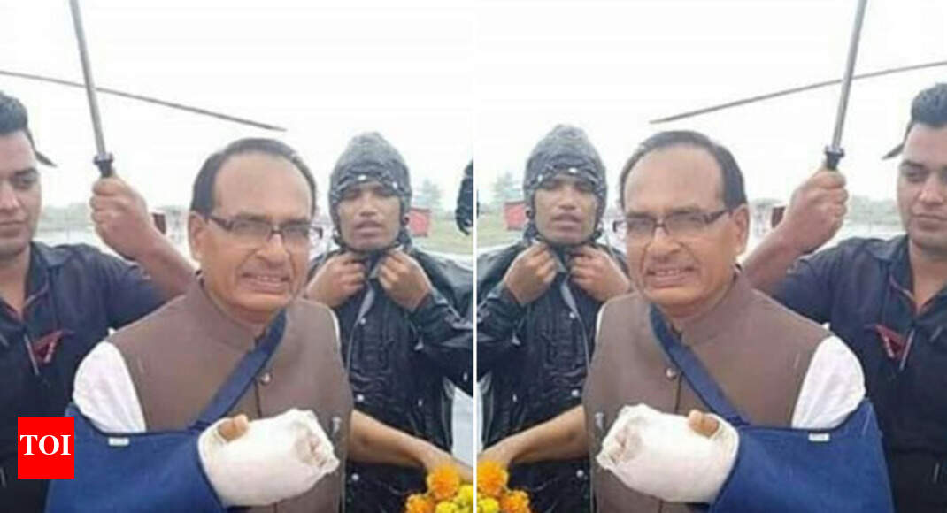 Fact check: Did Shivraj fake injury on his hand?