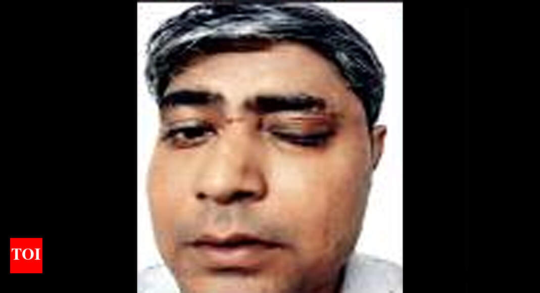 Kolkata Another kitestring injury on Maa flyover, close shave for