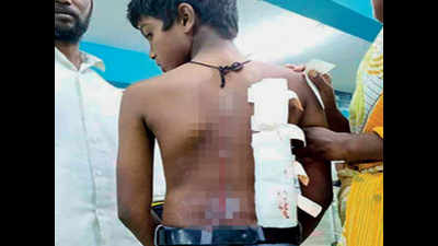 Madurai: Schoolboy cuts dalit classmate with blade