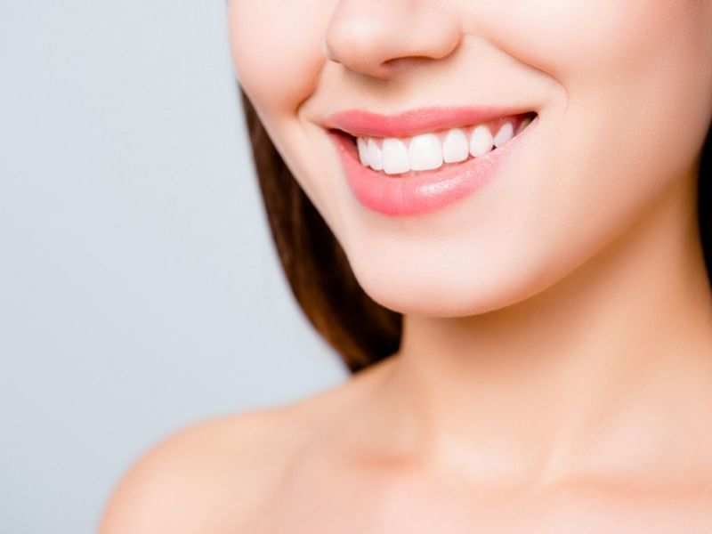 Teeth Whitening: What to Expect