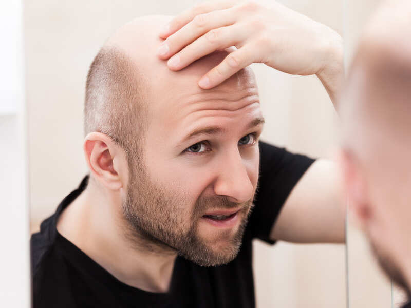 Hair loss treatment: Medicines for hair fall and hair regrowth - Times of  India