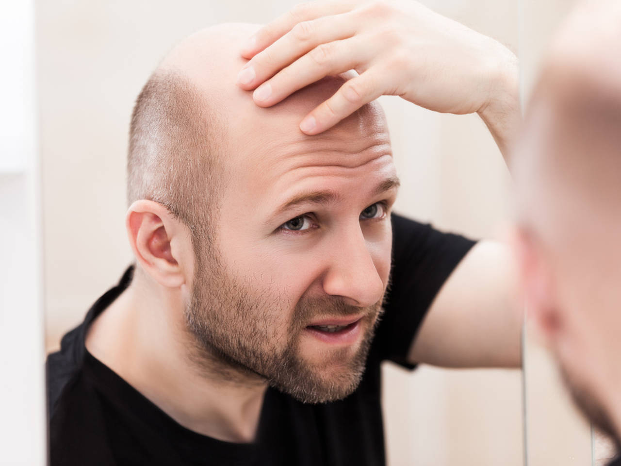 Hair loss Images and Stock Photos. 28,738 Hair loss photography and royalty  free pictures available to download from thousands of stock photo providers.