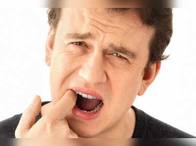 toothpaste to cure mouth ulcers