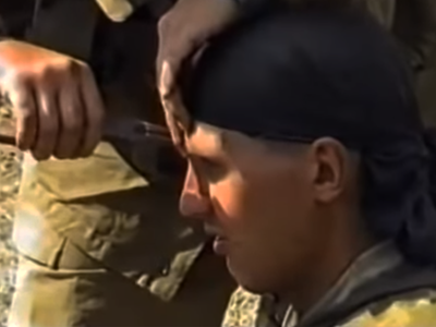 FAKE ALERT: No, this is not an Indian soldier getting a bullet removed from his forehead