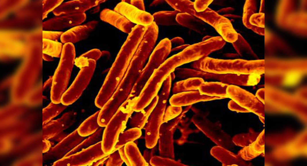 New study claims tuberculosis can be cured permanently - Misskyra.com