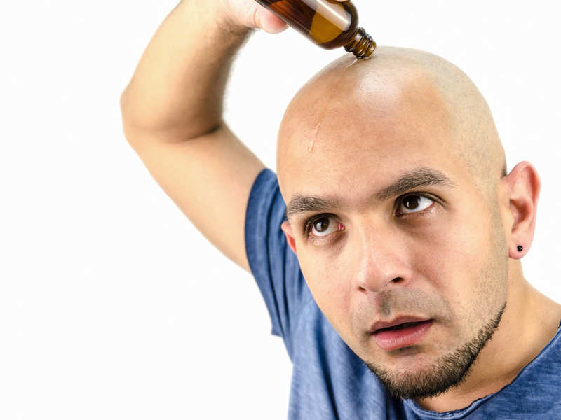Get rid of permanent hair loss with these advance treatments - Times of  India