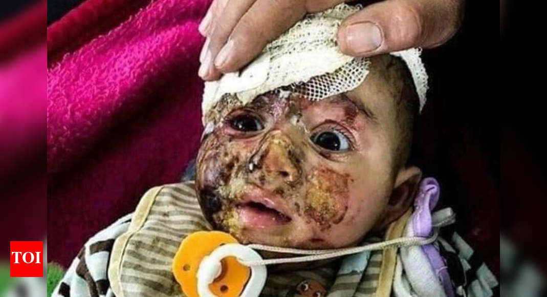 timesofindia.indiatimes.com