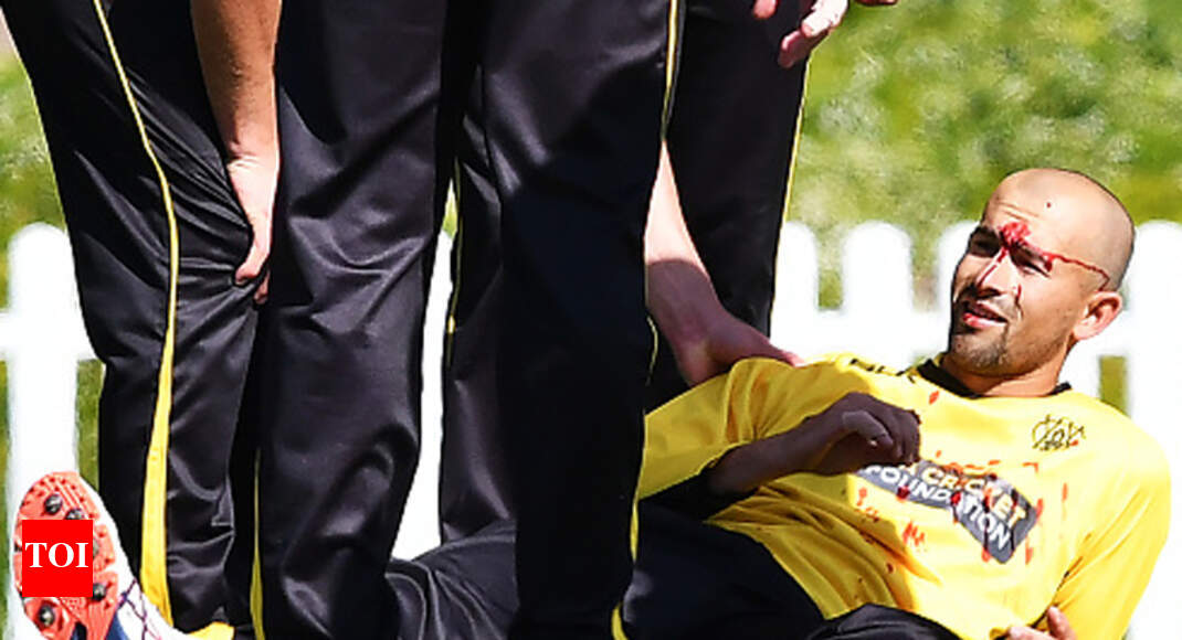 Australia S Ashton Agar Suffers Laceration To His Nose Glbnews Com