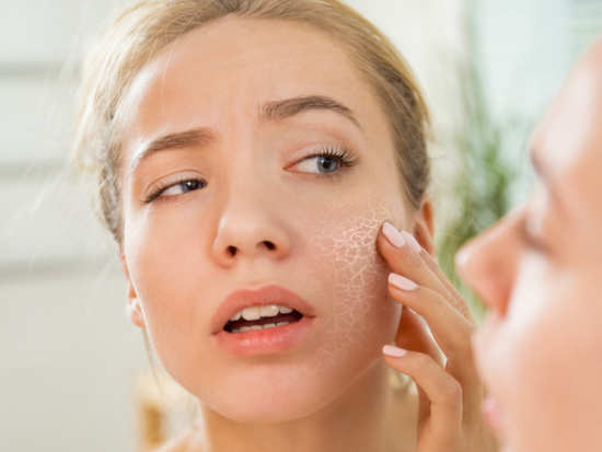 If you have dry skin, you must avoid these things at all costs