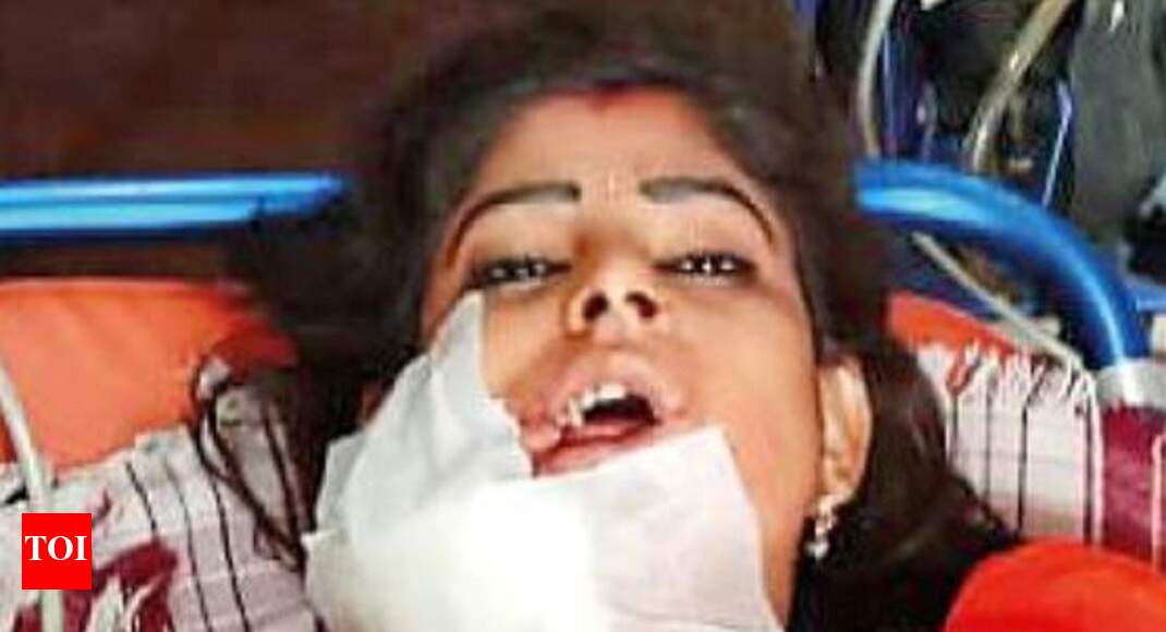 Woman dancer shot in face for pausing to rest