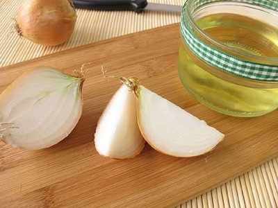 Onion hair oil: Fight dandruff, gray hair and adds shine to your hair