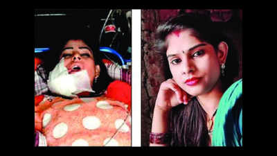 Uttar Pradesh: Jaw blown off, long haul for dancer shot in face