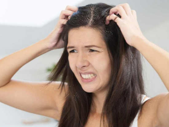 Oiling is not the solution to get rid of dandruff issues