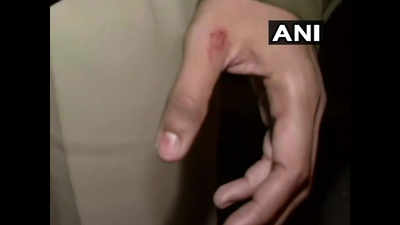 Woman bites IPS officer's thumb during JNU students' protest in Delhi