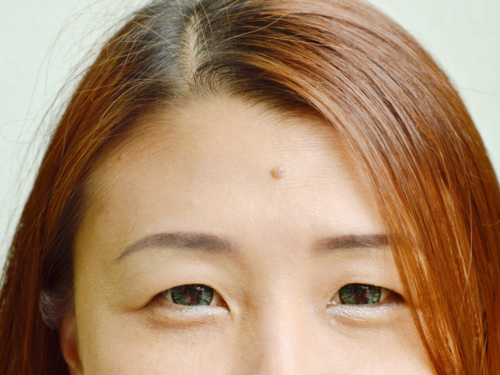 If You Have Moles On These 9 Body Parts You Are Really Lucky The Times Of India if you have moles on these 9 body parts