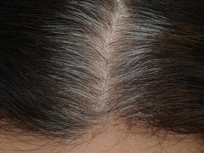 Scientists reveal the REAL reason why your hair is turning grey - Times of India Scientists reveal the REAL reason why your hair is turning grey - Times of India